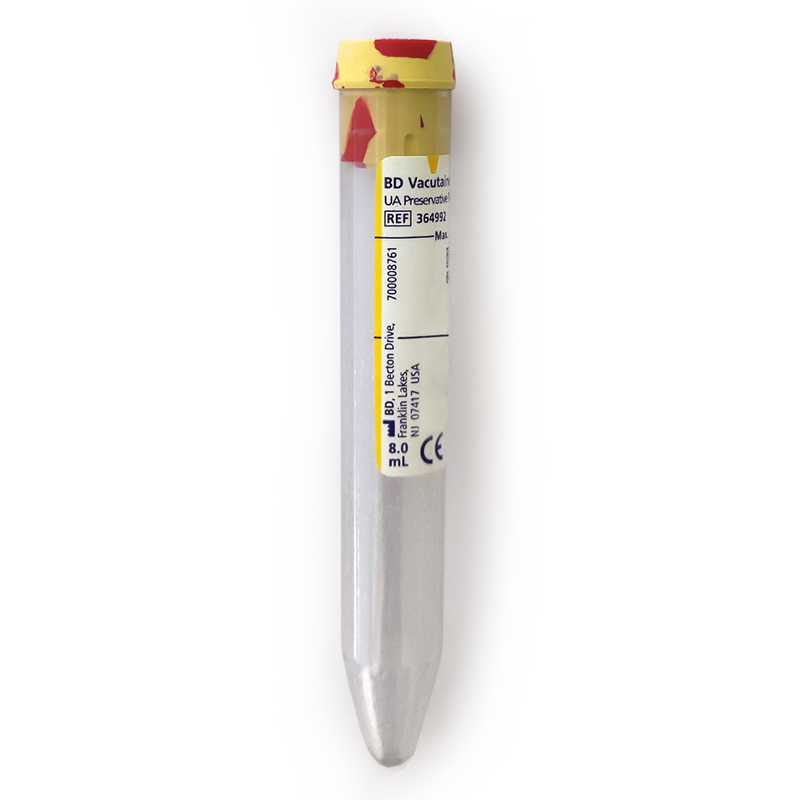 Вакуумні BD Vacutainer® Plus для загального аналізу сечі 8 мл, 100шт (364992)